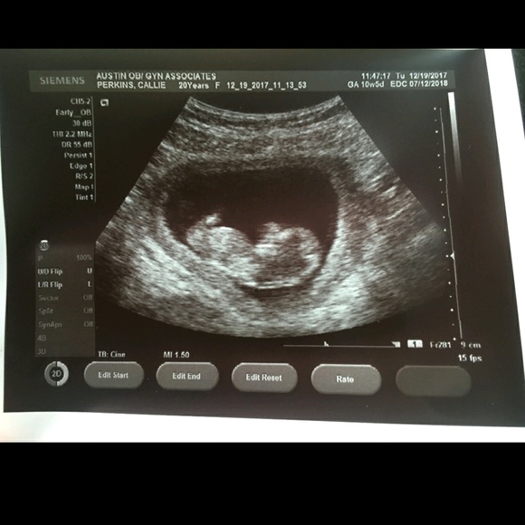 Meet your Posher, Stacy - Picture 1 of 1